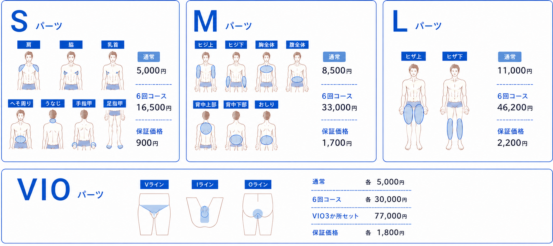 体のイラスト付きパーツ料金表。S・M・L・VIOの通常料金、6回コース料金、保証価格と対象部位。